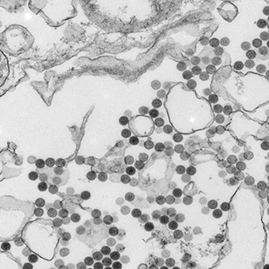 Heartland Virus Disease